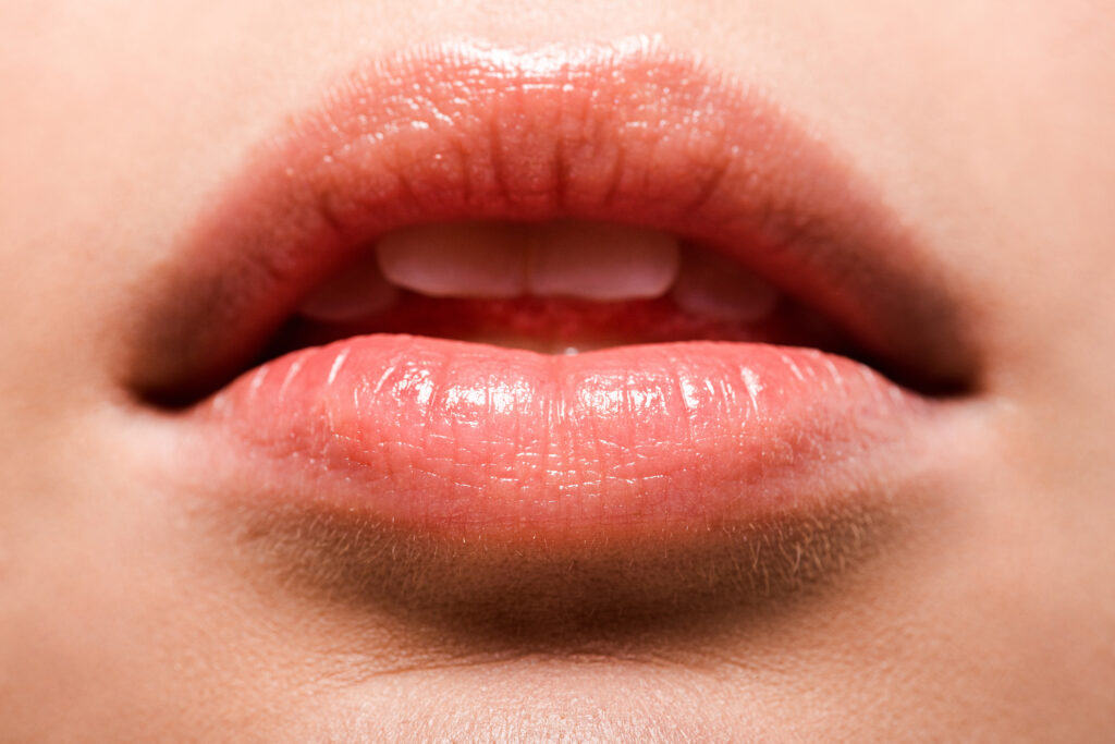 Understanding the lip filler swelling stages helps you feel confident as your lips heal and settle into their final shape.